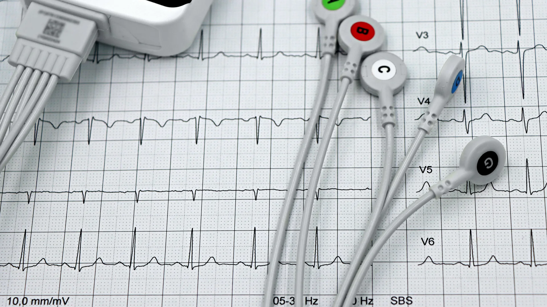 EEG electrodes and headphones used to measure neural response to sound.