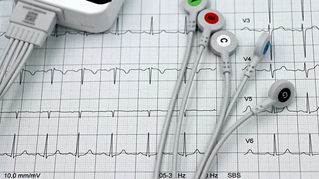 EEG electrodes and headphones used to measure neural response to sound.